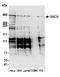 Sacsin Molecular Chaperone antibody, A305-325A, Bethyl Labs, Western Blot image 
