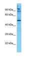 Adenosine Monophosphate Deaminase 1 antibody, orb330198, Biorbyt, Western Blot image 