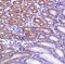 Survivin antibody, MA5-16401, Invitrogen Antibodies, Immunohistochemistry frozen image 