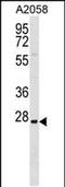 Tripartite Motif Containing 74 antibody, PA5-48925, Invitrogen Antibodies, Western Blot image 