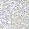 Serine Peptidase Inhibitor, Kunitz Type 2 antibody, A04176, Boster Biological Technology, Western Blot image 