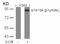 Signal Transducer And Activator Of Transcription 5A antibody, AP02347PU-N, Origene, Western Blot image 