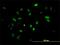 Checkpoint Kinase 2 antibody, H00011200-M01, Novus Biologicals, Immunofluorescence image 