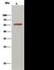 Aldehyde Dehydrogenase 7 Family Member A1 antibody, GTX02210, GeneTex, Immunoprecipitation image 