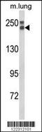 Collagen Type XVIII Alpha 1 Chain antibody, 63-671, ProSci, Western Blot image 