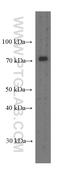 Peroxisomal Biogenesis Factor 5 antibody, 66309-1-Ig, Proteintech Group, Enzyme Linked Immunosorbent Assay image 