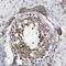 Mediator Complex Subunit 27 antibody, HPA007002, Atlas Antibodies, Immunohistochemistry frozen image 