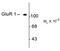 Glutamate Ionotropic Receptor AMPA Type Subunit 1 antibody, MA5-18117, Invitrogen Antibodies, Western Blot image 