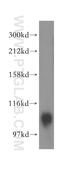 ATPase 13A1 antibody, 16244-1-AP, Proteintech Group, Western Blot image 