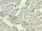 RPTOR Independent Companion Of MTOR Complex 2 antibody, LS-C377935, Lifespan Biosciences, Immunohistochemistry paraffin image 
