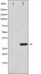 Activating Transcription Factor 1 antibody, TA325231, Origene, Western Blot image 