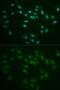 DNA Ligase 1 antibody, GTX55590, GeneTex, Immunocytochemistry image 