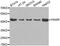 Pro-Apoptotic WT1 Regulator antibody, STJ24905, St John