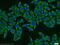 HPS3 Biogenesis Of Lysosomal Organelles Complex 2 Subunit 1 antibody, 10768-1-AP, Proteintech Group, Immunofluorescence image 