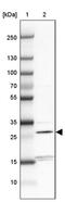 Thymocyte Nuclear Protein 1 antibody, PA5-58523, Invitrogen Antibodies, Western Blot image 