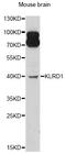 Killer Cell Lectin Like Receptor D1 antibody, A12698, ABclonal Technology, Western Blot image 