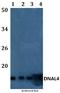 Dynein Axonemal Light Chain 4 antibody, A13115-1, Boster Biological Technology, Western Blot image 