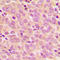 Insulin Receptor Substrate 1 antibody, LS-C368391, Lifespan Biosciences, Immunohistochemistry paraffin image 