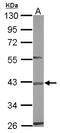 Gamma-Butyrobetaine Hydroxylase 1 antibody, LS-C185524, Lifespan Biosciences, Western Blot image 