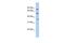 MINDY Lysine 48 Deubiquitinase 1 antibody, GTX45077, GeneTex, Western Blot image 