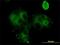 Grancalcin antibody, H00025801-M01, Novus Biologicals, Immunofluorescence image 