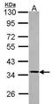 Protein Phosphatase 4 Catalytic Subunit antibody, GTX114659, GeneTex, Western Blot image 