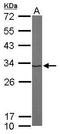Proteasome Subunit Alpha 1 antibody, GTX104373, GeneTex, Western Blot image 