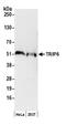 Thyroid Hormone Receptor Interactor 6 antibody, A300-335A, Bethyl Labs, Western Blot image 