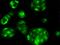 Estrogen Receptor 2 antibody, 101626-T02, Sino Biological, Immunohistochemistry frozen image 