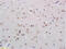 Lysine Demethylase 5B antibody, GTX60284, GeneTex, Immunohistochemistry paraffin image 