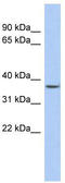 Forkhead box protein E3 antibody, TA329392, Origene, Western Blot image 
