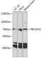 TBC1 Domain Family Member 23 antibody, 23-818, ProSci, Western Blot image 