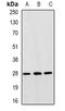 Myosin Heavy Chain 11 antibody, orb388488, Biorbyt, Western Blot image 