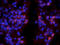 Phosphatidylinositol-5-Phosphate 4-Kinase Type 2 Alpha antibody, orb247977, Biorbyt, Immunofluorescence image 