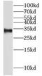 Meiotic Nuclear Divisions 1 antibody, FNab05253, FineTest, Western Blot image 