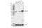 Coronin 1A antibody, 92904S, Cell Signaling Technology, Western Blot image 