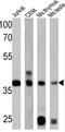 RAD51 Recombinase antibody, MA5-14419, Invitrogen Antibodies, Western Blot image 