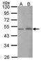 C-Terminal Binding Protein 2 antibody, GTX114346, GeneTex, Western Blot image 