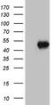 Ankyrin Repeat And BTB Domain Containing 1 antibody, M11982, Boster Biological Technology, Western Blot image 