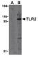 Toll Like Receptor 2 antibody, LS-B1417, Lifespan Biosciences, Western Blot image 