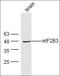 Eukaryotic Translation Initiation Factor 2B Subunit Gamma antibody, orb183339, Biorbyt, Western Blot image 