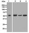 TNF Receptor Associated Factor 2 antibody, ab126758, Abcam, Western Blot image 