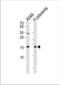 NME/NM23 Nucleoside Diphosphate Kinase 1 antibody, TA324587, Origene, Western Blot image 