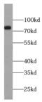 Myb Like, SWIRM And MPN Domains 1 antibody, FNab05527, FineTest, Western Blot image 