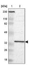 Ribosomal Protein Lateral Stalk Subunit P0 antibody, NBP1-82859, Novus Biologicals, Western Blot image 