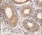 HBGF-1 antibody, PA5-13394, Invitrogen Antibodies, Immunohistochemistry paraffin image 