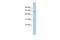 LEM Domain Containing 2 antibody, GTX45193, GeneTex, Western Blot image 