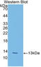 Lysyl Oxidase Like 2 antibody, LS-C298477, Lifespan Biosciences, Western Blot image 