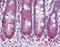 Matrix Metallopeptidase 11 antibody, NBP1-40030, Novus Biologicals, Immunohistochemistry frozen image 