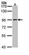 Minichromosome Maintenance Complex Component 7 antibody, orb73768, Biorbyt, Western Blot image 